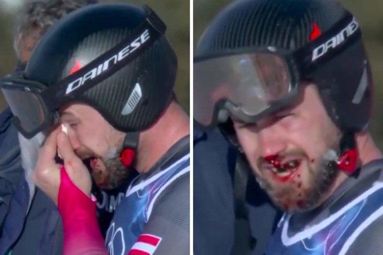 Jeziv pad Austrijanca na "Stazi strave". Pogledajte kako je završio krvav na ZOI-ju