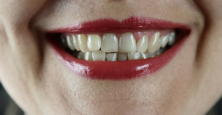 Ortodont otkriva što boja zuba govori o našem zdravlju