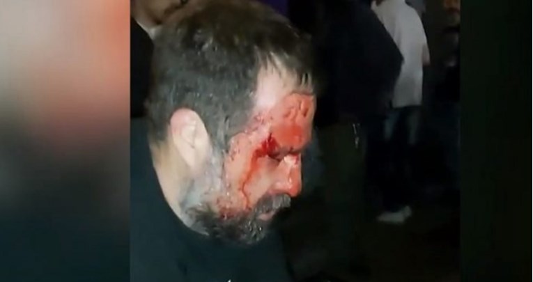 VIDEO Prosvjednik pretučen u Beogradu: "Policija je šibala koga je stigla"