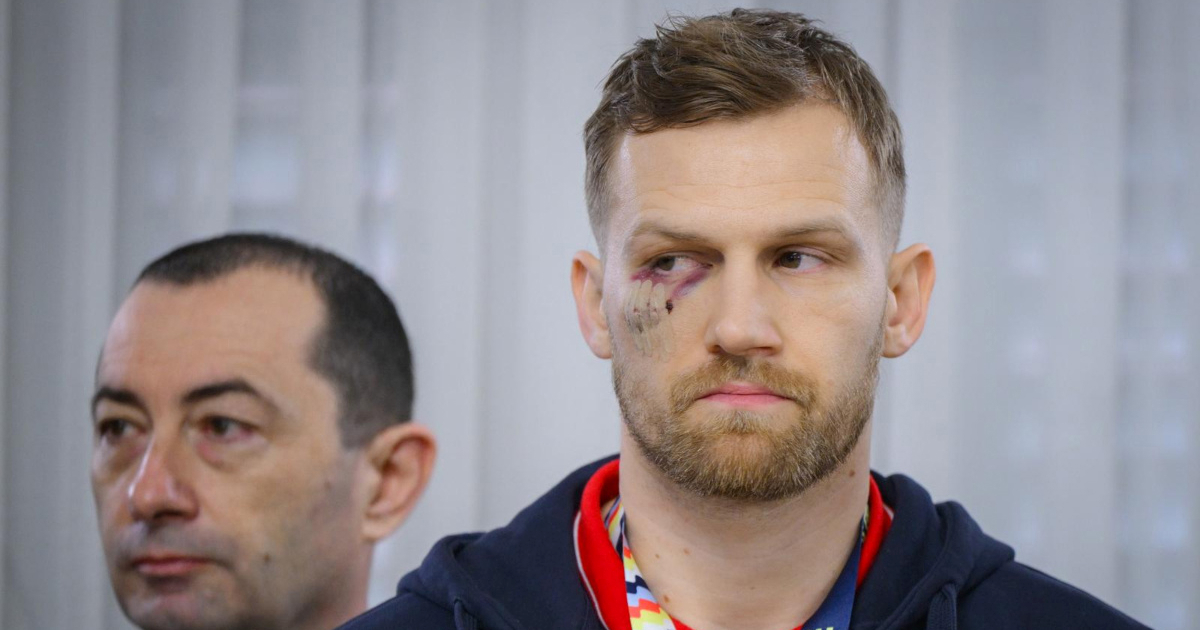 Krvavog je lica napustio utakmicu za broncu. Pogledajte kako danas izgleda