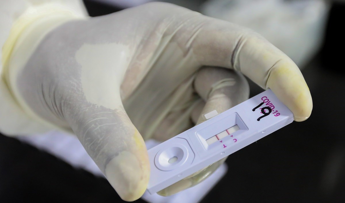 U Sloveniji otkriven mutirani soj korone, sumnja se na to da se radi o britanskom