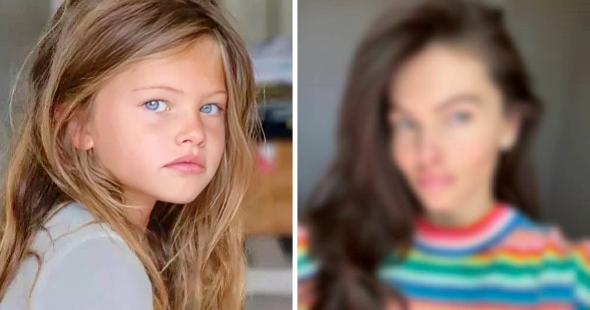 Neke rastužila fotka najljepše djevojčice na svijetu: "Žrtva je filera za usne"