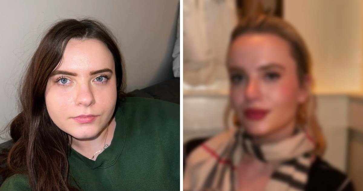 Žena (27) otkrila tajnu svoje nevjerojatne transformacije lica: "Bez operacije"