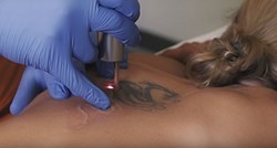 Kako nestaju tetovaže? Dermatolog otkriva detalje o proceduri uklanjanja