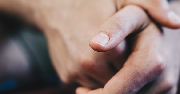 Ove promjene na noktima mogu upućivati na dijabetes