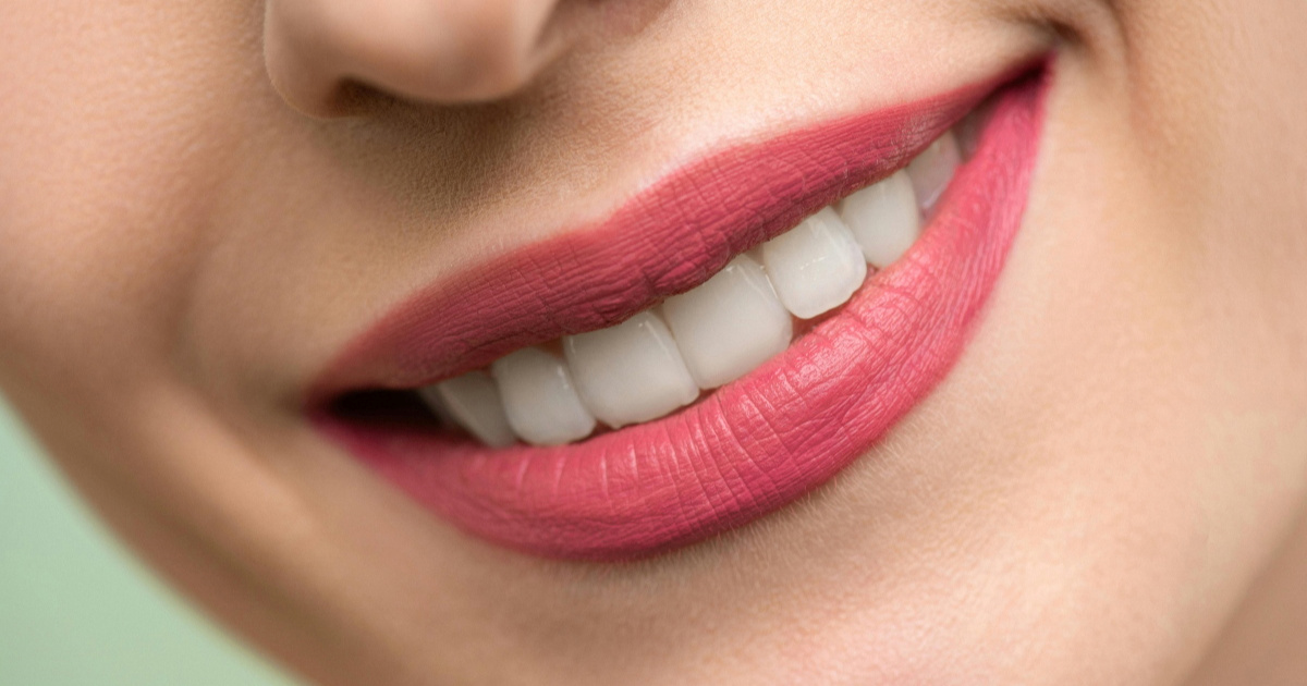 Stomatolozi upozoravaju: Izbjegavajte ove metode izbjeljivanja zubi