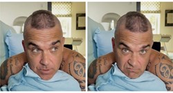 Robbie Williams o tretmanima za rast kose: Dvije injekcije su koštale kao bakina kuća