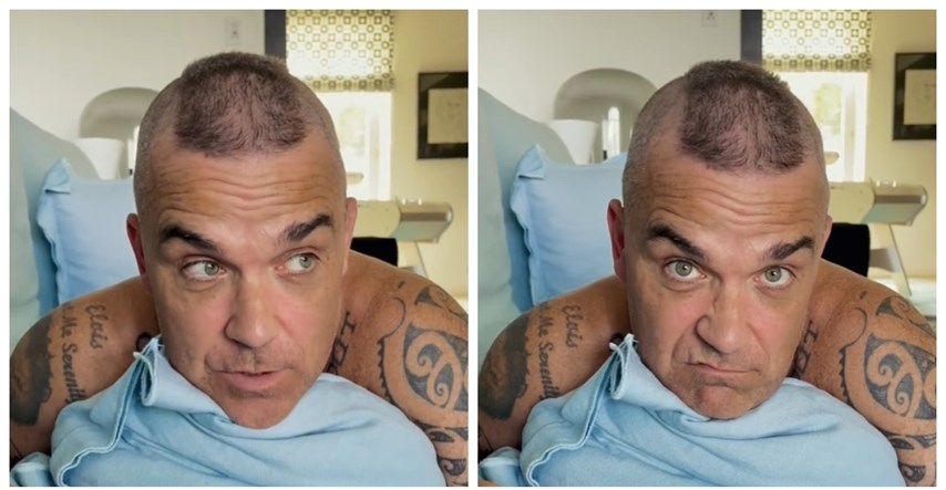 Robbie Williams o tretmanima za rast kose: Dvije injekcije su koštale kao bakina kuća