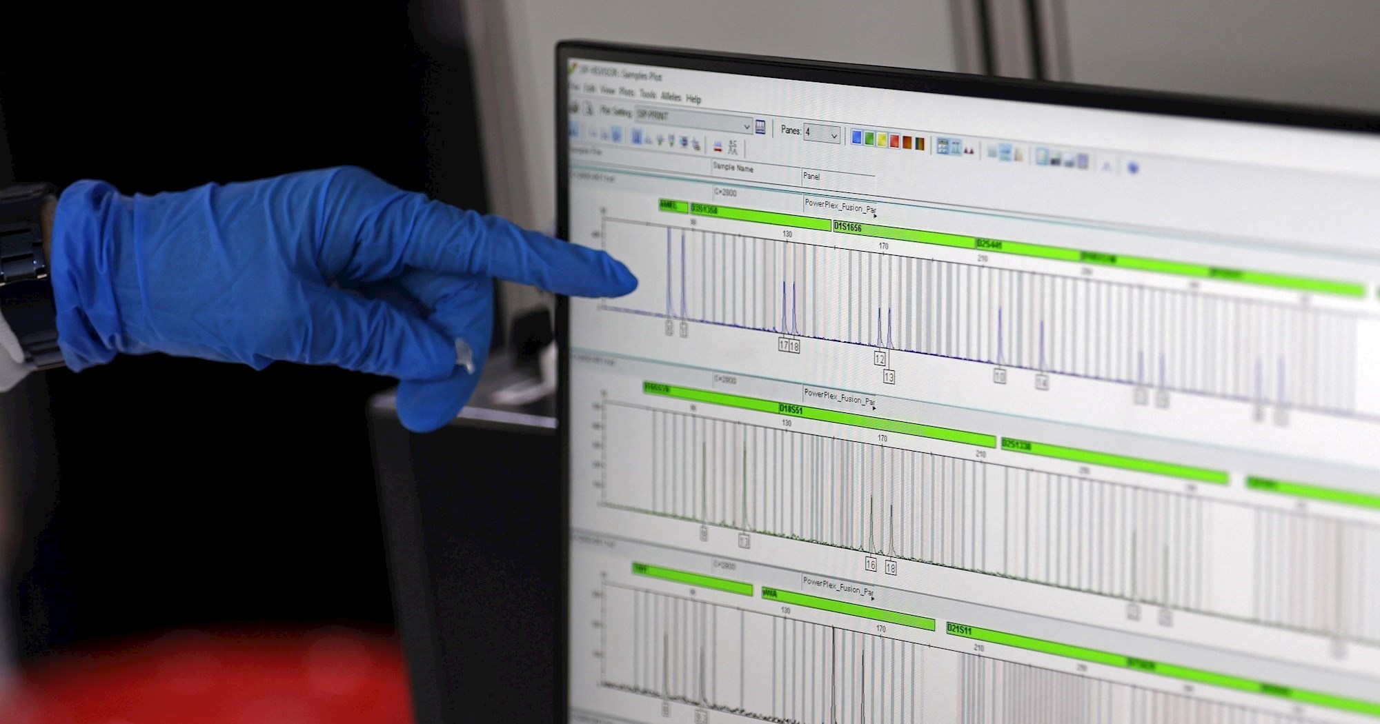 Liječnici prvi put modificirali DNK djeteta kako bi ispravili genetski poremećaj