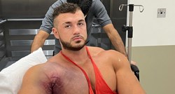 Stravična snimka: Bodybuilder slučajno zabilježio trenutak kada mu je pukao mišić