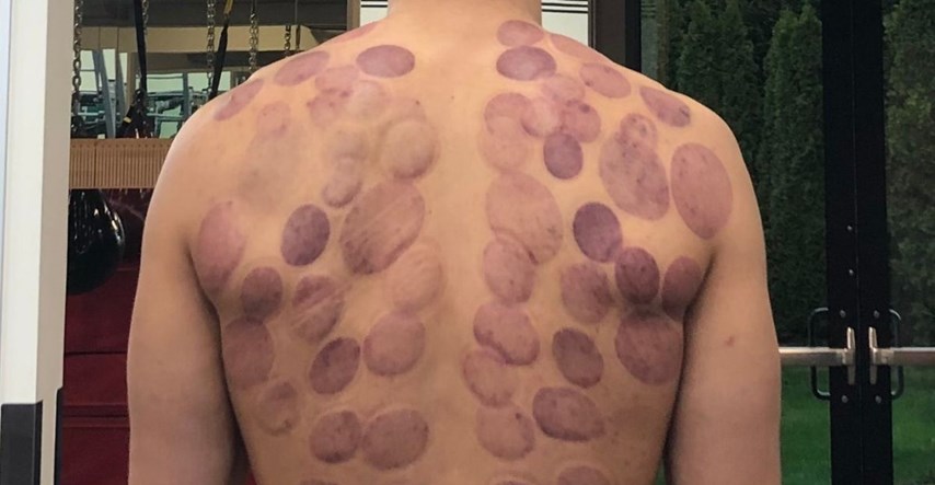 NBA košarkaš objavio fotografiju svojih leđa. Ovo nisu tetovaže