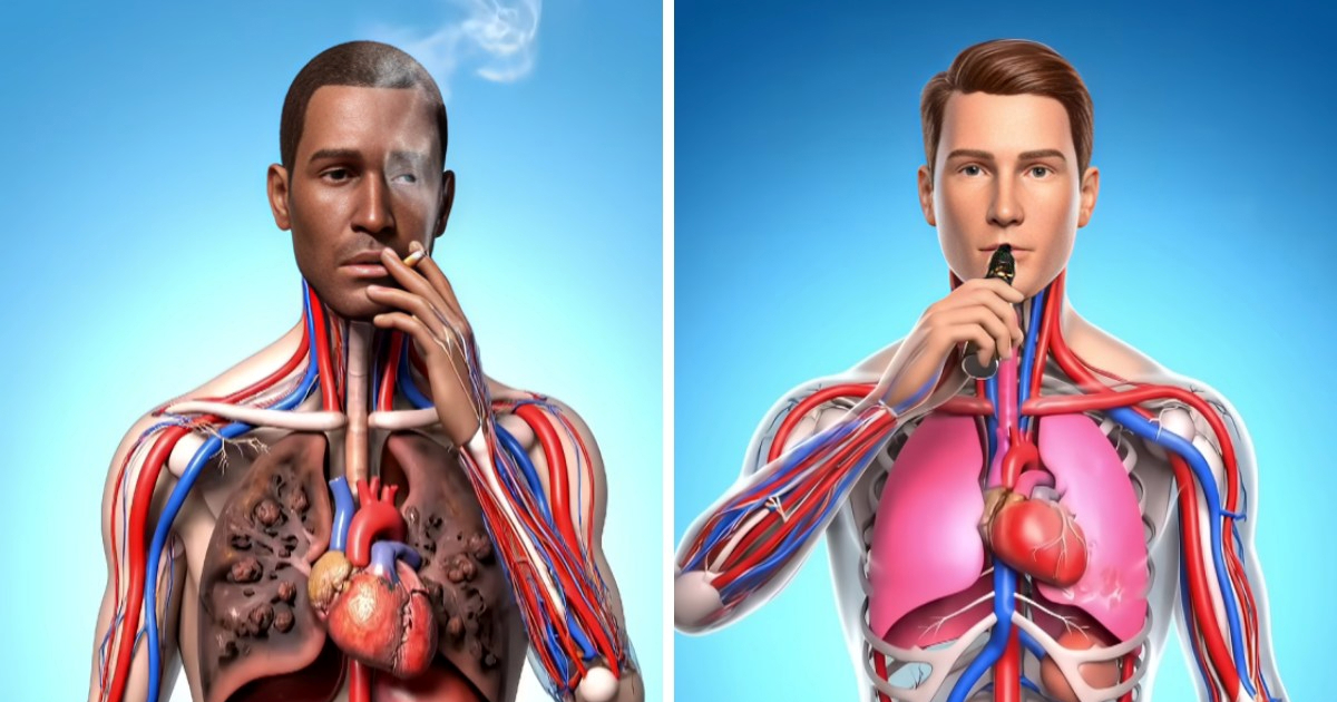 Simulacija usporedila pušenje i vapeanje: Što je gore za tijelo?