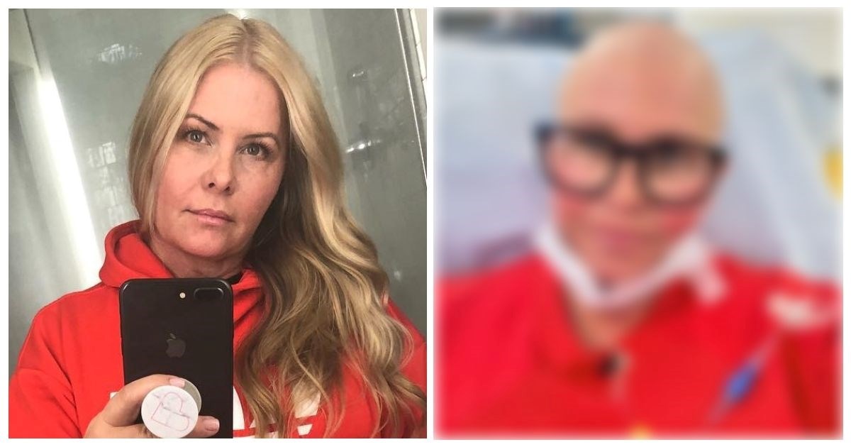 Nicole Eggert objavila fotku iz bolnice i pokazala kako izgleda bez kose