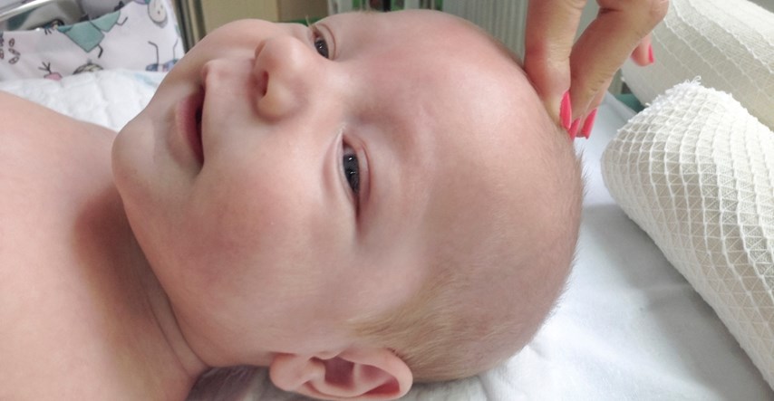 Mama dijeli znak koji je uočila na bebinoj glavi, a koji je bio simptom meningitisa