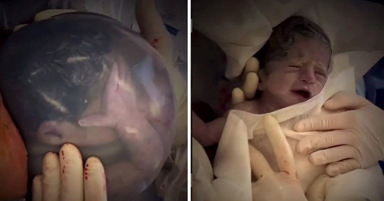 Jedan u 80.000 slučajeva: Čudesni video bebe rođene u vodenjaku dirnuo milijune
