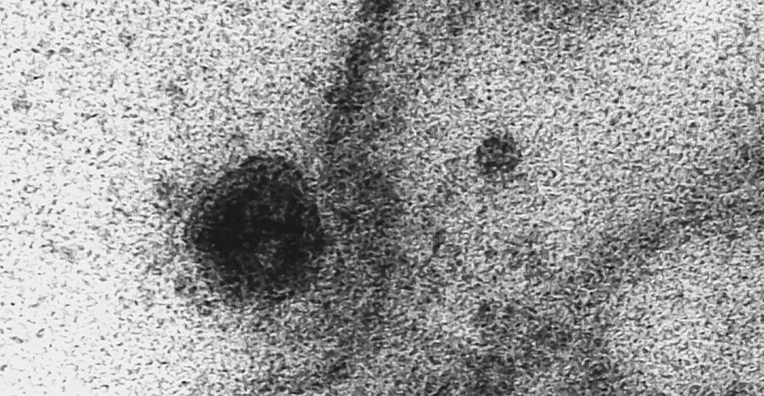 FOTO Snimljen točan trenutak kada koronavirus napada stanicu i inficira je