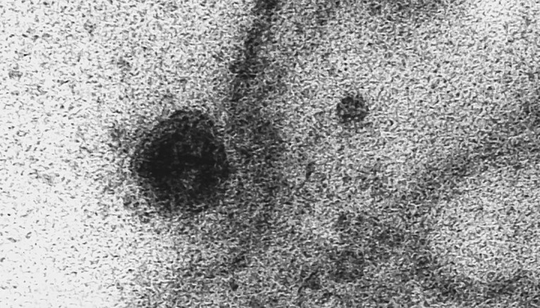 FOTO Snimljeno kako koronavirus napada, ulazi i inficira stanicu