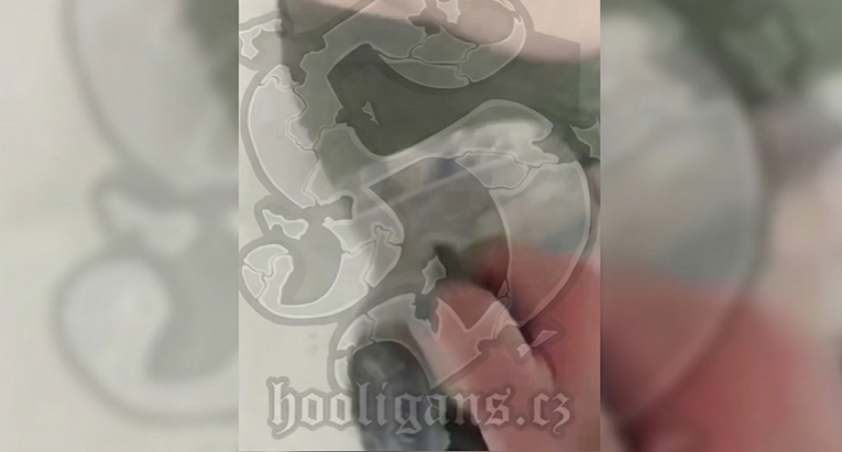 Palili mu tetovažu Torcide. "Ovdje će ostati crno jer ti si jedna nula"