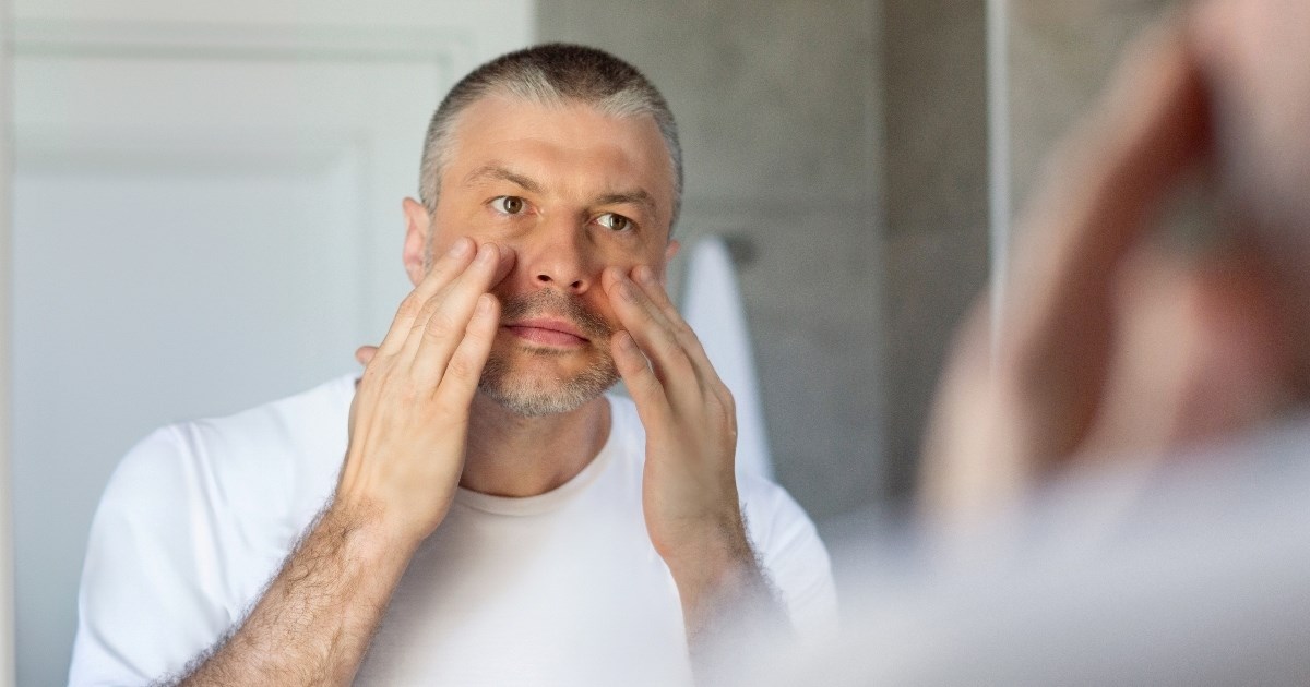 Prvi znakovi povišenog kolesterola mogu se pojaviti na koži