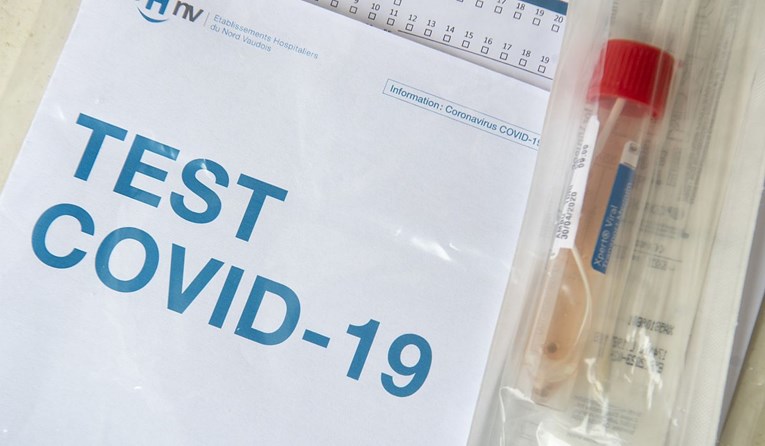 Južnokorejski znanstvenici: Ljudi ne mogu oboljeti od covida-19 dva puta