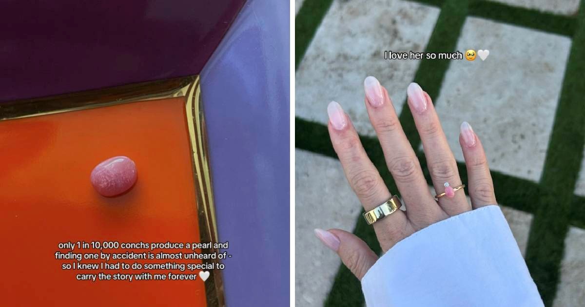 Mislila da je slomila zub na večeri, a pronašla je rijetko i vrijedno blago