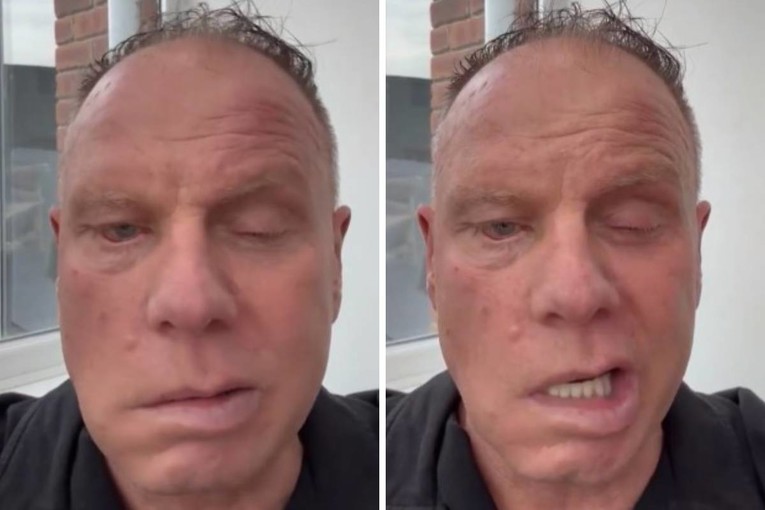 VIDEO Bivši kapetan Cityja progovorio o bolesti koja mu je deformirala lice
