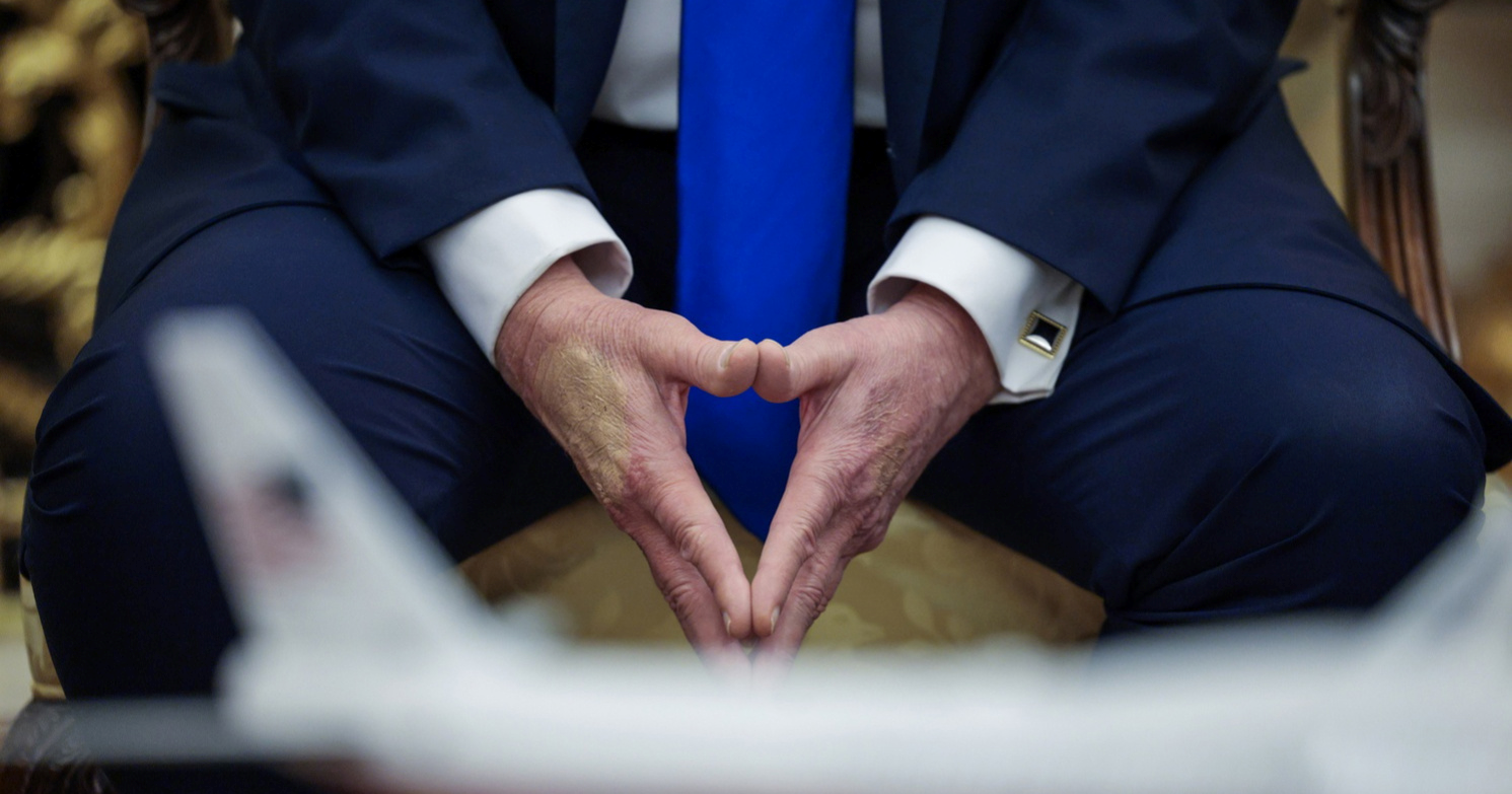 Trump na ruci ima nove modrice. Bijela kuća ne daje objašnjenja