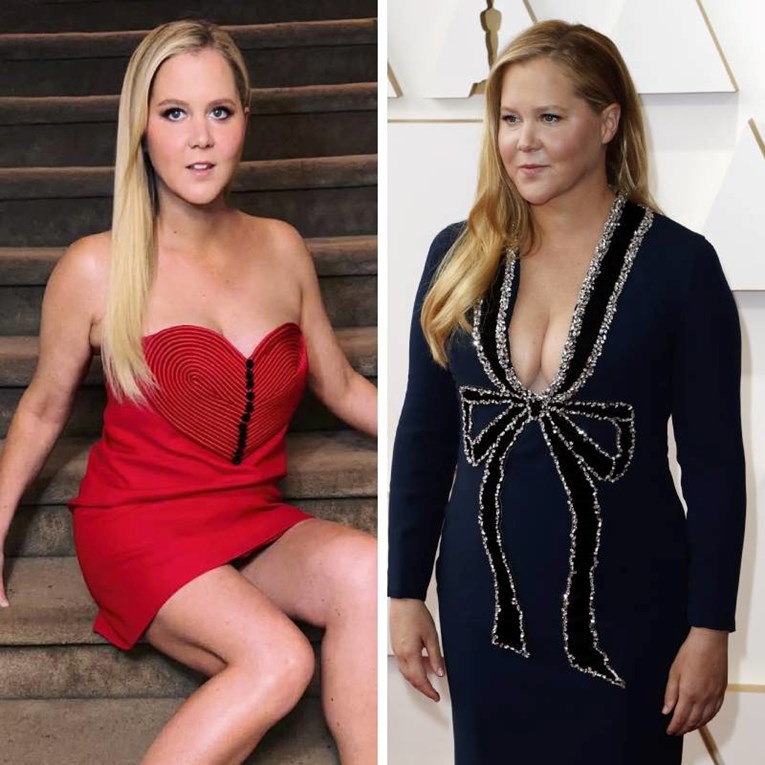 Nakon što je drastično smršavila, Amy Schumer obrisala sve stare fotke s Instagrama