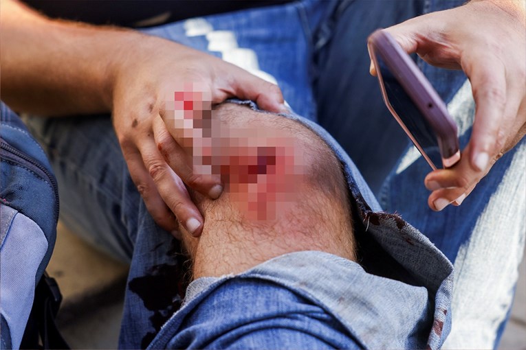 Britanski fotograf pogođen gumenim metkom u Los Angelesu. Opisao kako je to