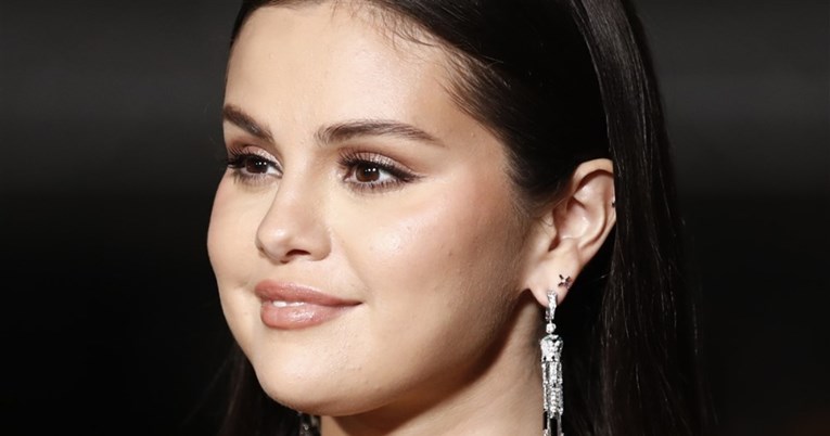 Što je lupus, stanje od kojeg boluje Selena Gomez?