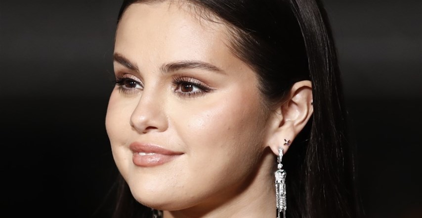 Što je lupus, stanje od kojeg boluje Selena Gomez?