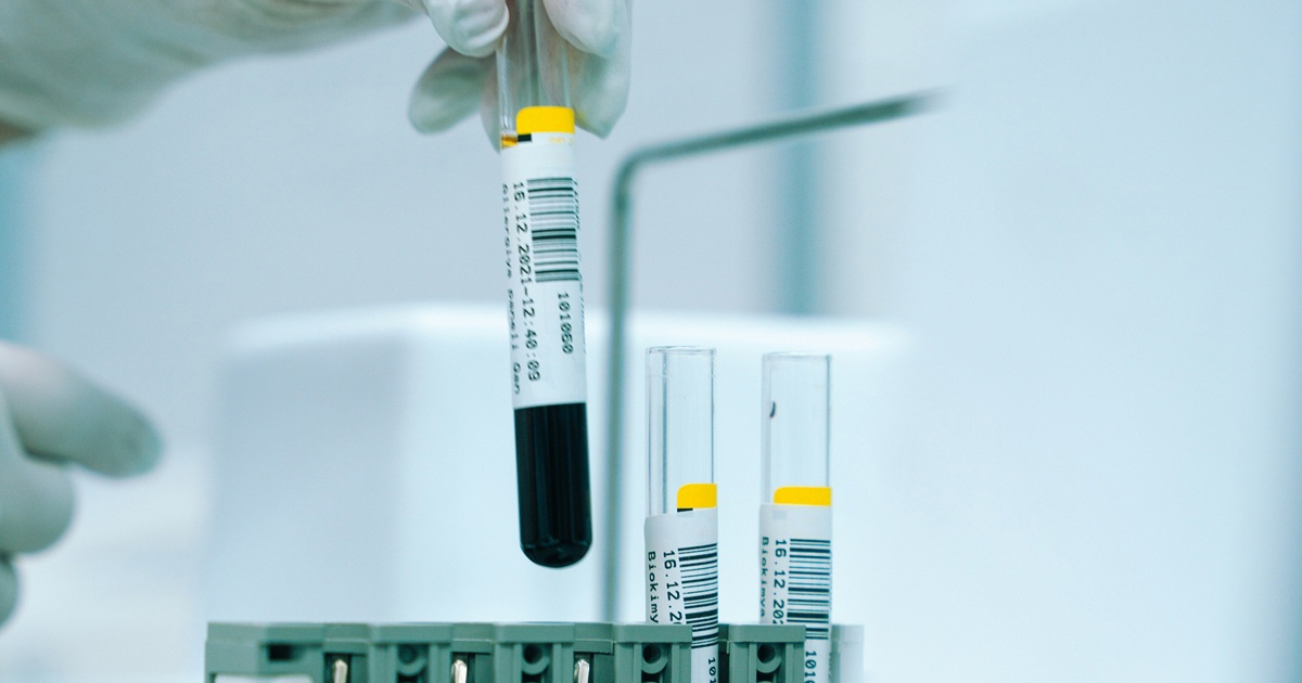 Otkrivene neobične četverolančane DNA strukture u ljudskoj krvi