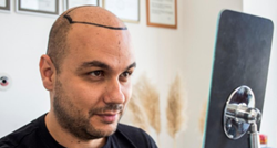 Svjetski poznata klinika za transplantaciju kose otvorila svoja vrata i u Sarajevu