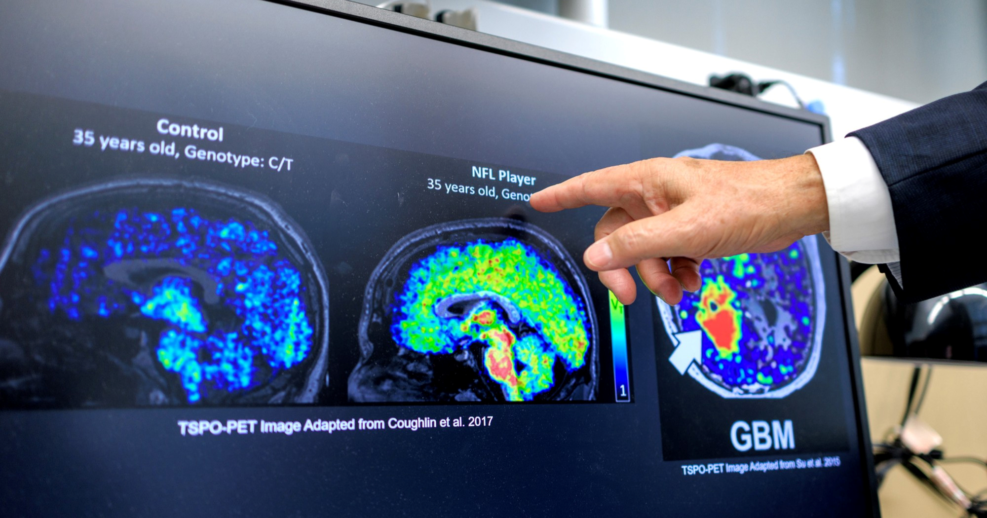 NYT: Trump gasi američki sustav istraživanja raka, posljedice će biti tragične