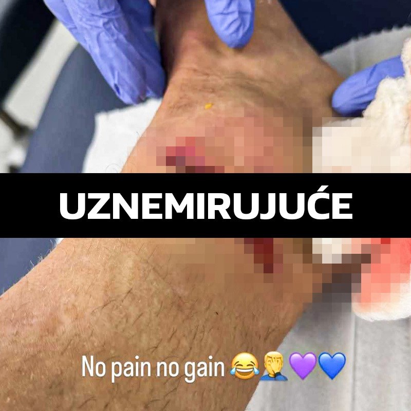 Igrač Aston Ville poludio zbog prekršaja na njemu. Objavio je sliku jezive ozljede