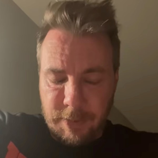 Dax Shepard imao štucavicu 50 sati bez prestanka, supruga ga snimala