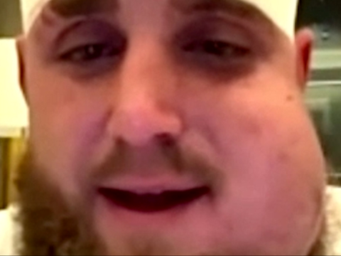 Ovako izgleda Paul nakon što mu je Joshua na dva mjesta slomio čeljust