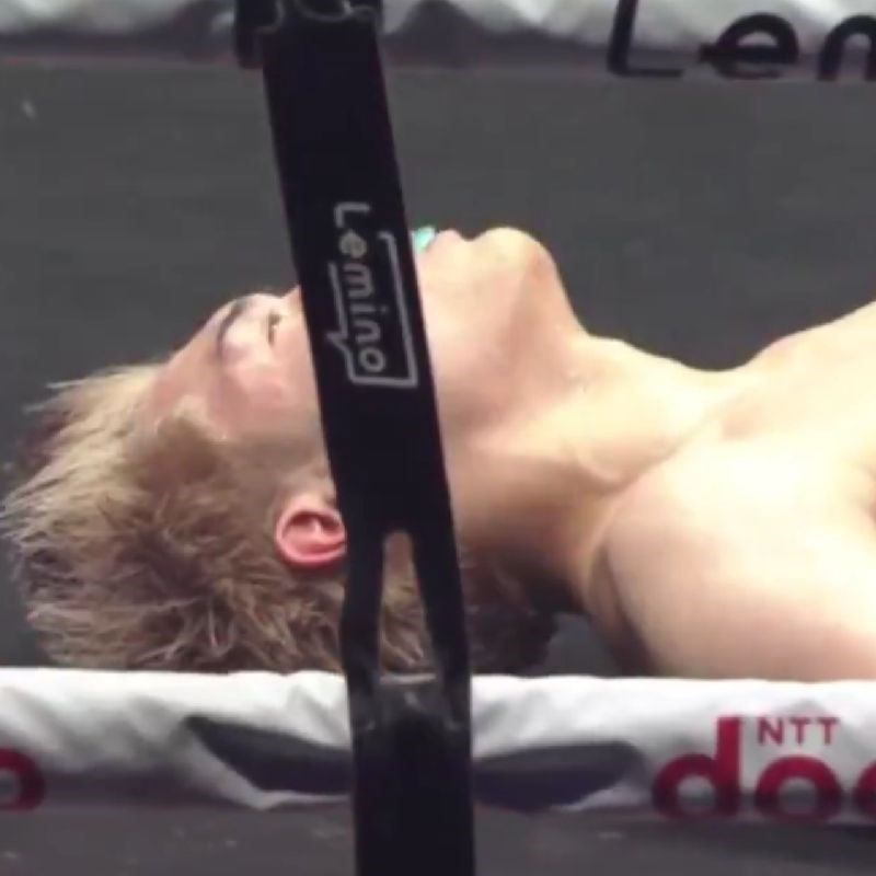 VIDEO Japanac brutalno nokautiran. Ne sjeća se zadnjih šest tjedana života