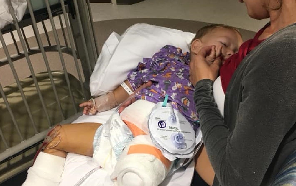 Malenog Šimuna operirali 9 sati u SAD-u, sada će moći hodati