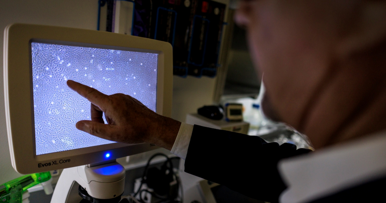 Rak i Alzheimer rijetko se javljaju zajedno. Otkriveno zašto