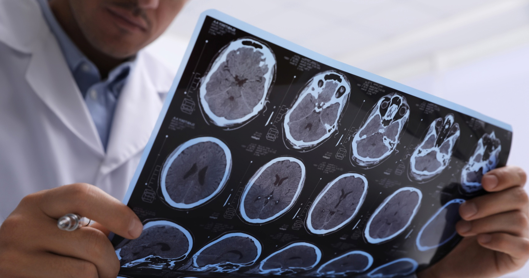 Mozak naglo stari u tri ključne dobi