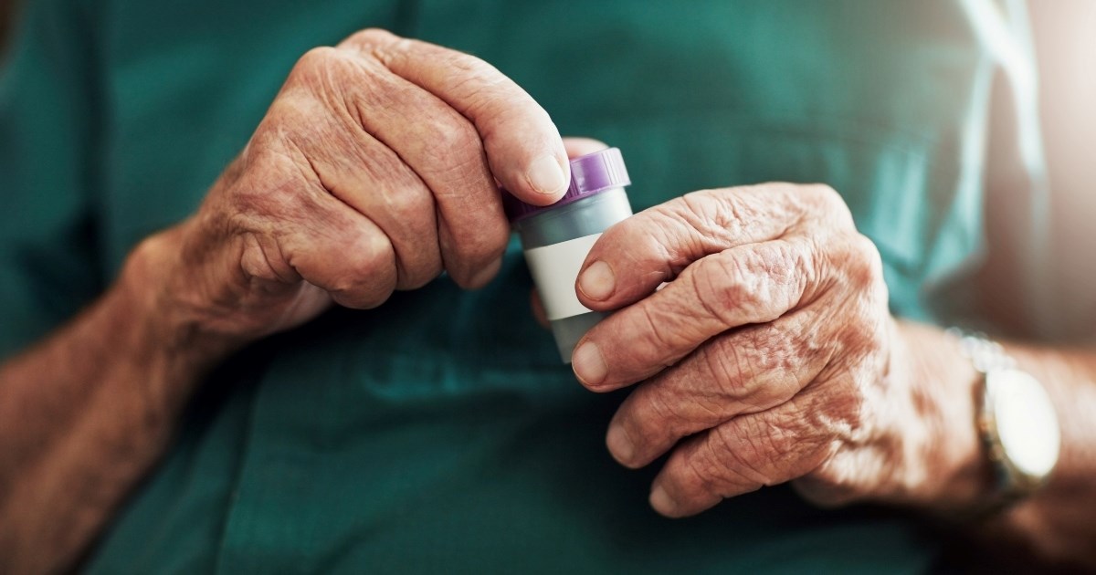 Liječnici: Niske razine jednog vitamina mogu povećati rizik od demencije