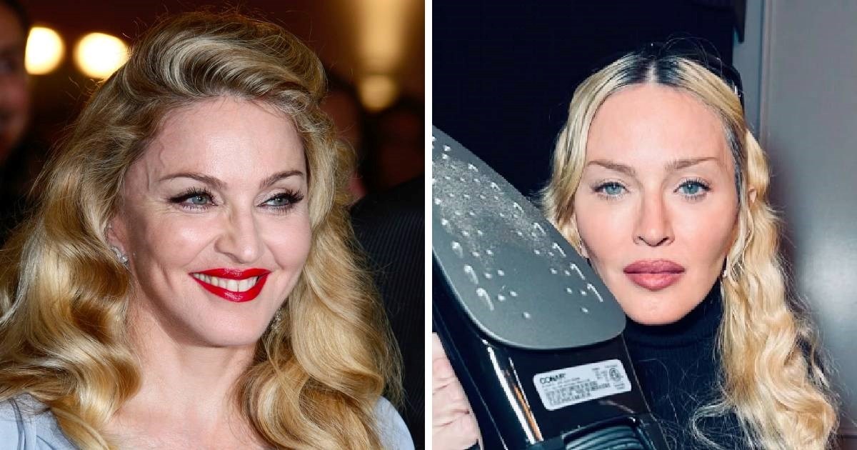 Zašto holivudski celebovi odjednom izgledaju 20 godina mlađe?