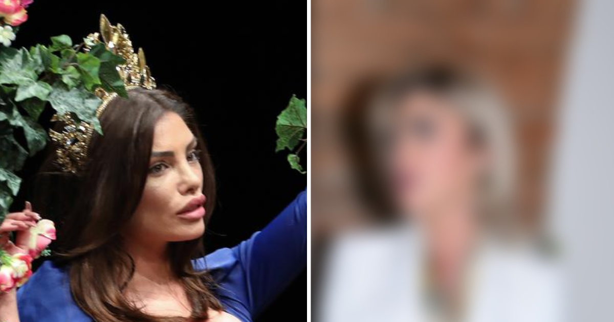 Bivša misica o zahvatima: Doktor je rekao da me ne želi vidjeti sljedećih 10 godina