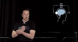 Elon Musk: Za šest mjeseci ćemo ugraditi prve bežične čipove u ljudski mozak