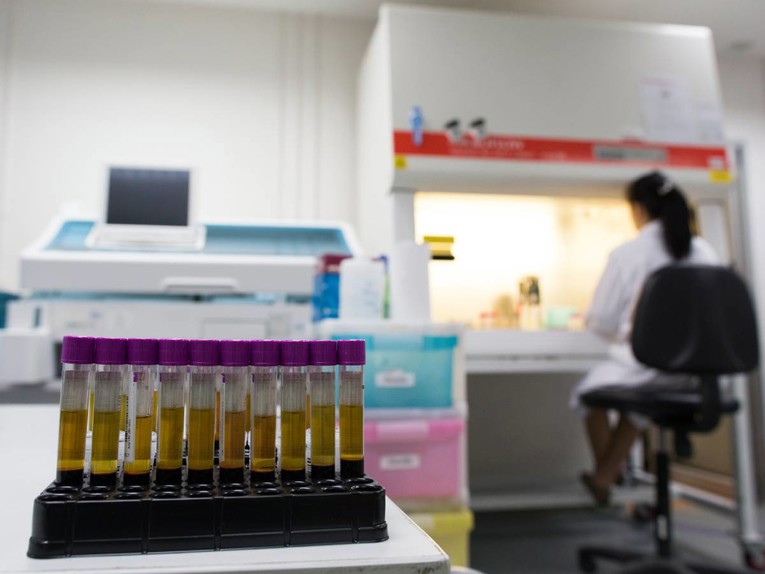 UN-ova agencija upozorava: Svijetu prijeti povratak epidemije HIV-a