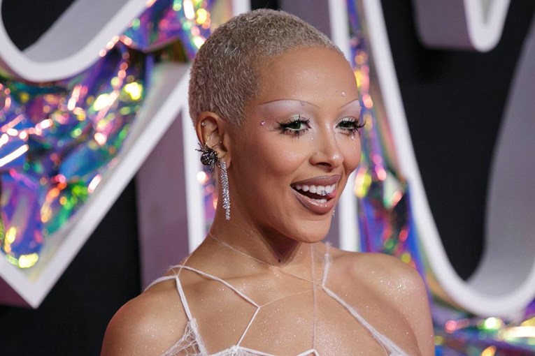 Doja Cat: Dijagnosticiran mi je granični poremećaj osobnosti