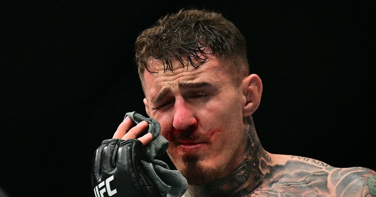 Aspinall nije mogao nastaviti borbu zbog uboda u oko. Jones ga ismijao slikom