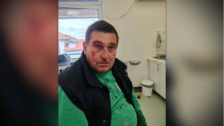 Otac i sin pretučeni u Srbiji nakon što su vučićevcima doviknuli "pumpaj"