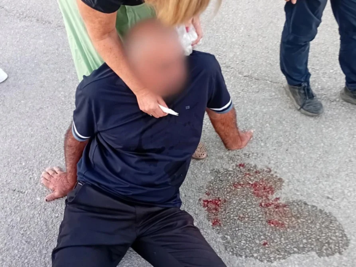 Napadnut političar kod Dubrovnika, kamenom mu razbili glavu
